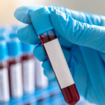 Blood Test