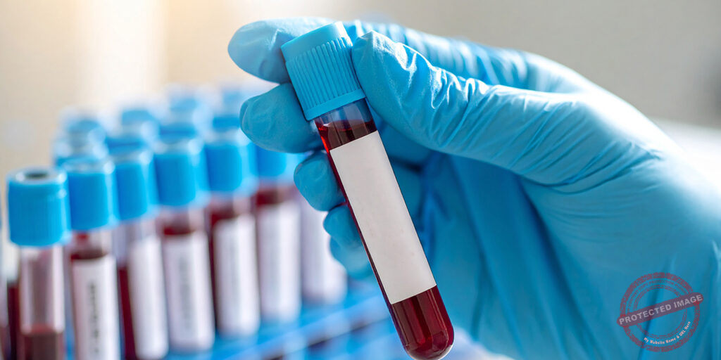 Blood Test
